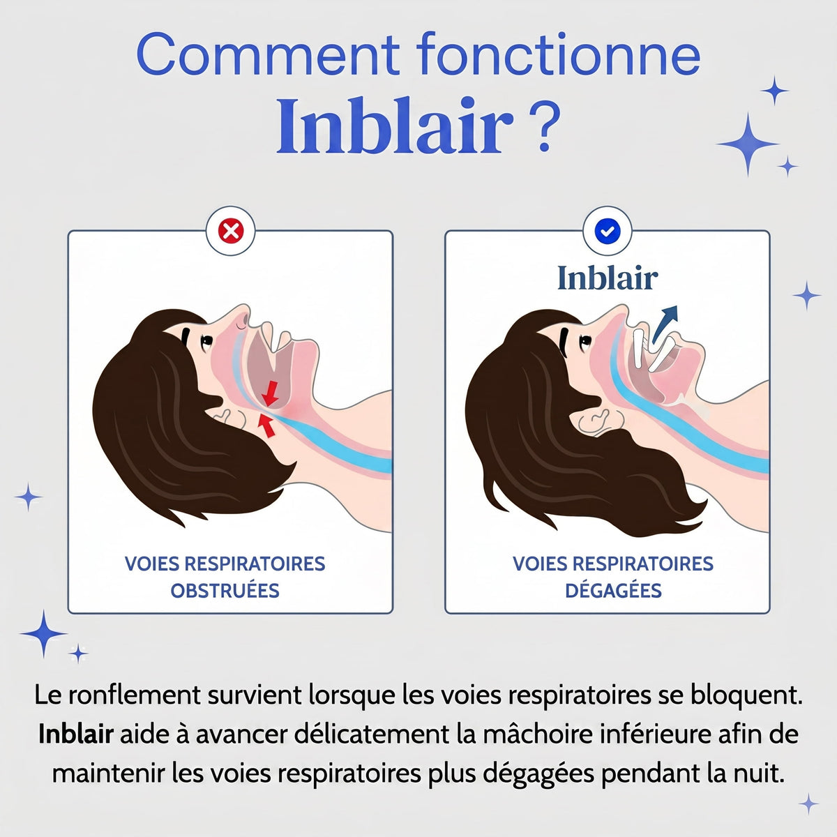 Inblair – Gouttière anti-ronflement ajustable